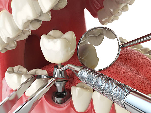 Best Broken Tooth Emergency  in Langdon, ND