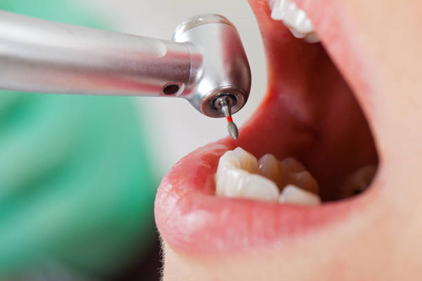 Best Affordable Emergency Dental Care  in Langdon, ND